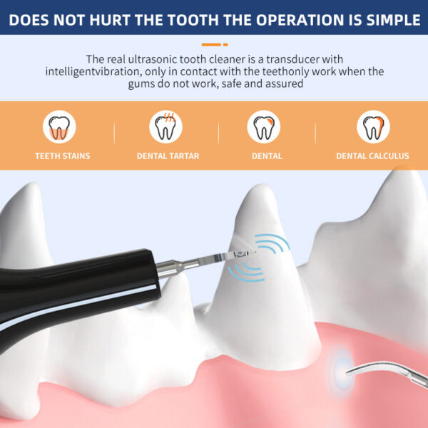 Ultrasonic Pet Teeth Cleaning And Cleaning Device - Image 8