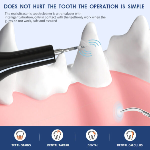 Ultrasonic Pet Teeth Cleaning And Cleaning Device - Image 4